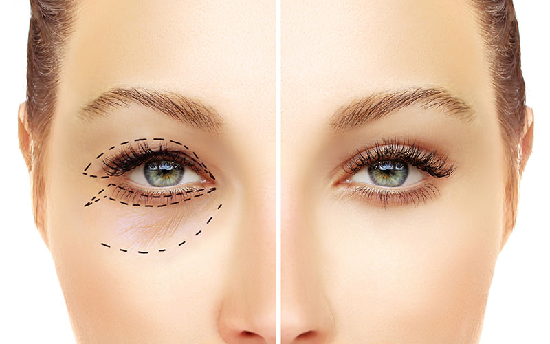 Principais sintomas nos primeiros dias de recuperação